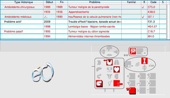 tableau VCM